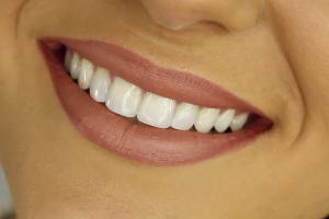 cepillo interdental